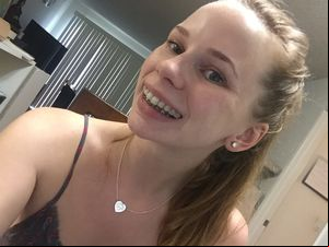 Got my braces on! - Yelp